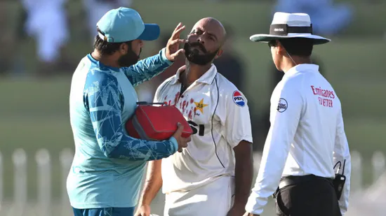 Pakistan Star's Daring Display: Smacked on the Face, Hits Sixes with Blood Dripping, Remains Unstoppable against England